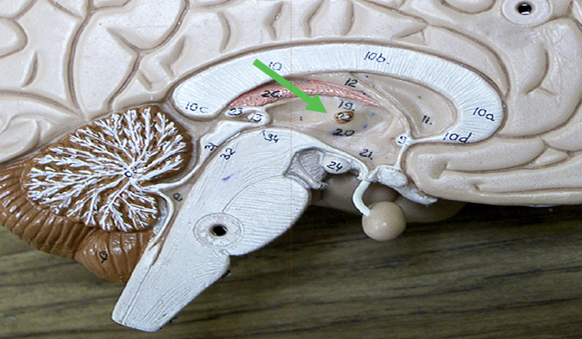 <p>Identify the area of the brain indicated by the pointer.</p>