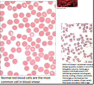 <ul><li><p>Biconcave disc-shaped cells</p></li><li><p>7–8 μm wide, 2.5 μm thick</p></li><li><p>Develop from cells in bone marrow</p><ul><li><p><strong>Lose organelles </strong>along the way</p></li><li><p>Mainly contain oxygen-carrying <strong>hemoglobin</strong></p></li><li><p>Active enzymes</p></li><li><p>E.g.<strong> carbonic anhydrase</strong>, glycolytic pathway</p></li></ul></li></ul><p></p>