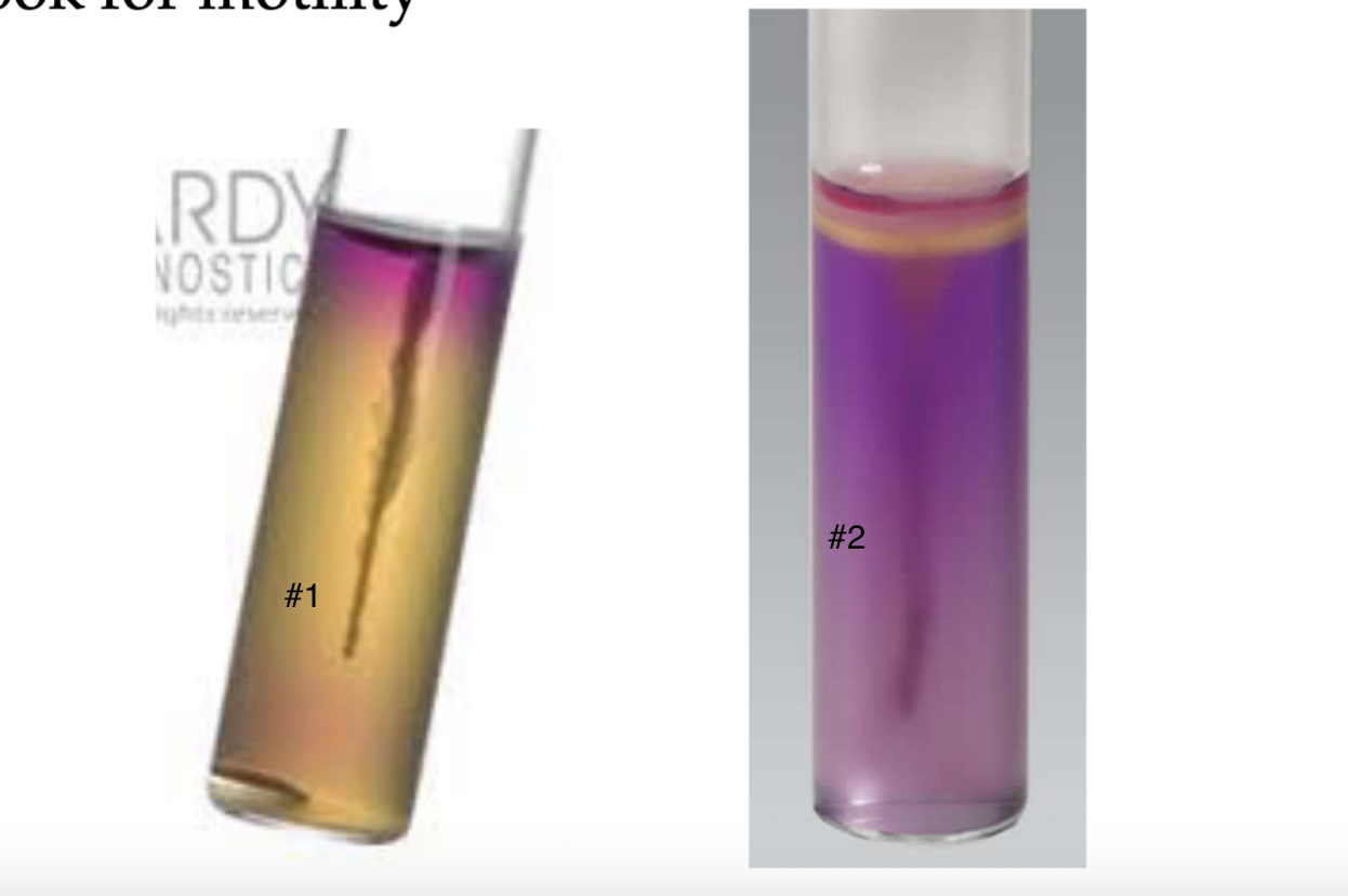 <p>Which one shows motility (turbidity) ?</p>