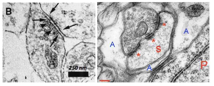 <p><span style="font-family: "Helvetica Light";">&nbsp;- when multiple release sites (aka presynaptic active zones) are positioned across from their own postsynaptic density, we call this a split, or <em><u>perforated synapse</u></em>.</span></p>