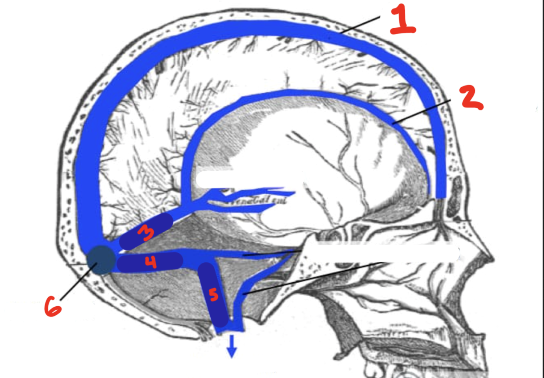 <p>#3. Between the pons and brain</p>