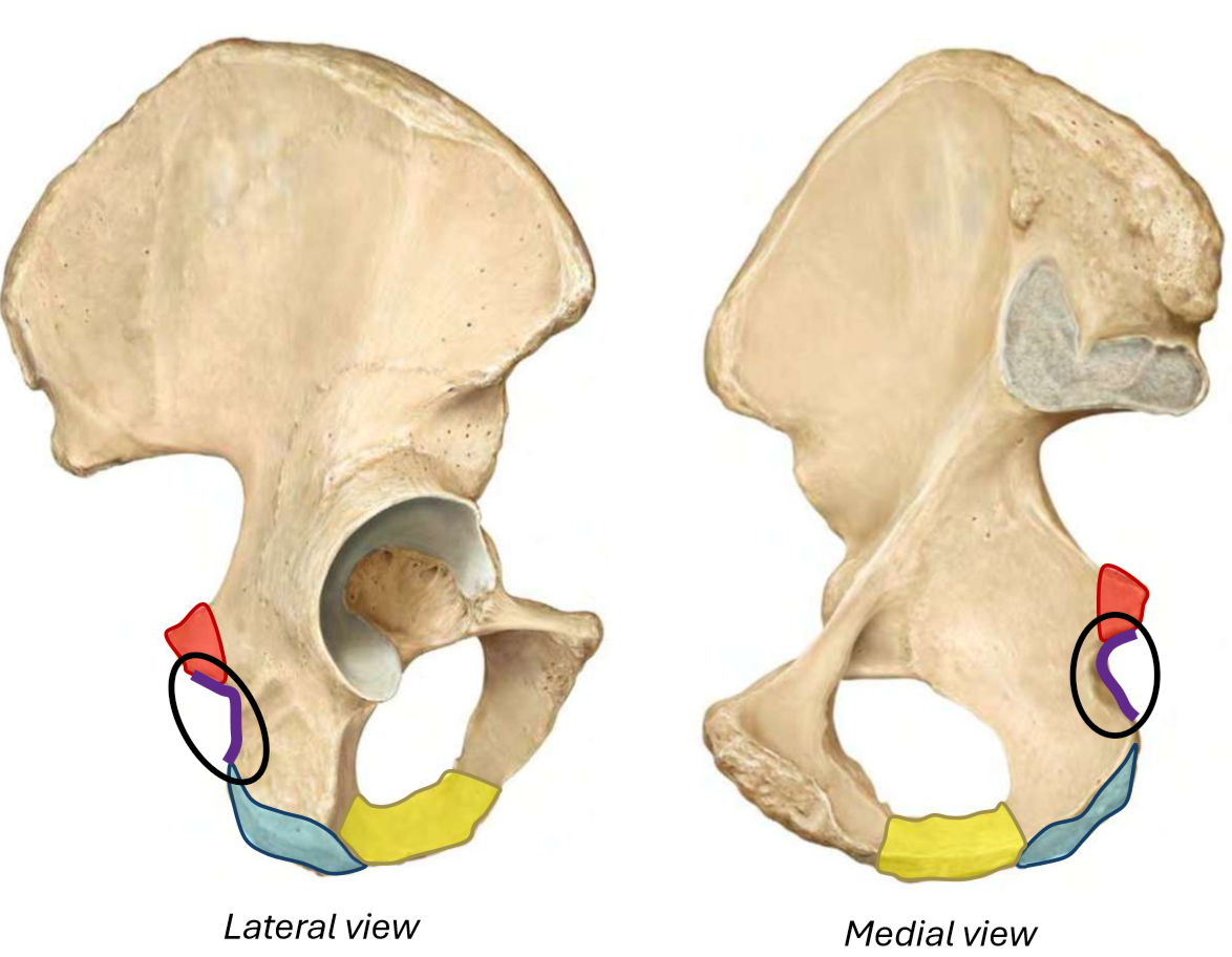 term image