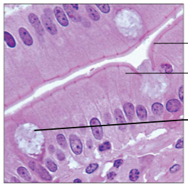 <p>Absorption; secretion of mucus, enzymes, and other substances; ciliated type propels mucus (or reproductive cells) by ciliary action</p>