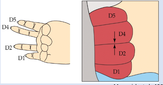 <p>1984- plasticity after peripheral trauma- Merzenich et al. showed alterations of input can change map structure in ADULT animals -even after amputation (of a finger), ‘silent’ zone not created, instead rfs of amputated zone in S1 now driven by adjacent fingers</p>