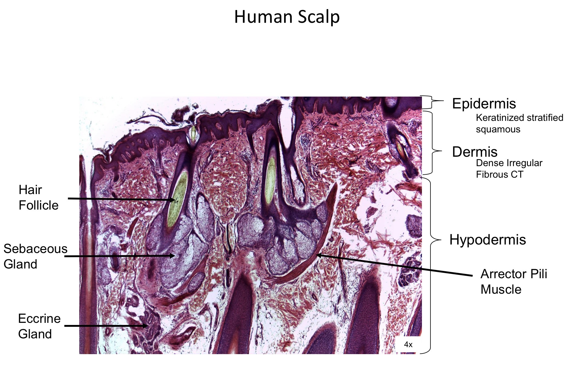<ol><li><p>Hair follicle </p></li><li><p>Sebaceous gland </p></li><li><p>Eccrine gland </p></li><li><p>Epidermis </p></li><li><p>Dermis </p></li><li><p>Hypodermis</p></li><li><p>Arrector pili muscle </p></li></ol><p></p>