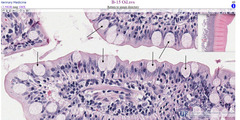 <p>What cell type is indicated by the arrows in this slide of a small intestine?</p>