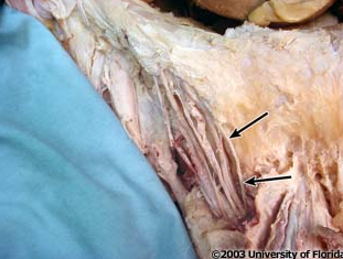 <p>what nerve is being indicated to in the image? (context: image is taken of spermatic cord)</p>