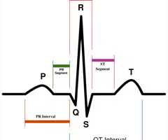 <p><span>represents the total time for ventricular depolarization and repolarization, is measured from the beginning of the QRS complex to the end of the T wave</span></p>