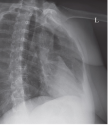 <p><span style="background-color: transparent;">attempt at OBL ribs</span></p>