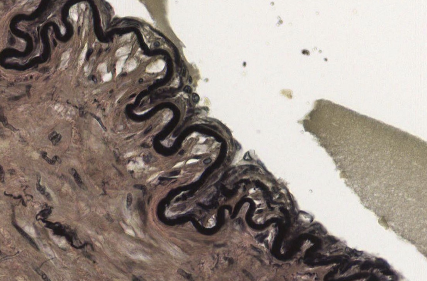 <p>Identify the Vessel and the Layer pictured</p>