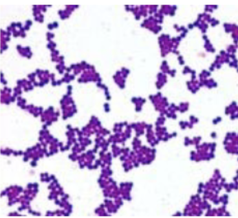 <p>Gram and morphology of this bacteria: purple stained bacteria with a spherical morphology</p>