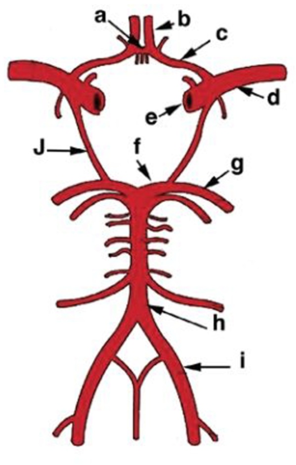 <p><span style="background-color: transparent;">Label these significant cerebral arteries (lettered) with either abbreviations or full names.</span></p>