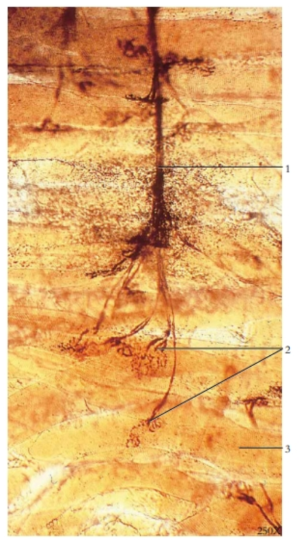 <p>Cross-section of unmyelinated nerve</p>