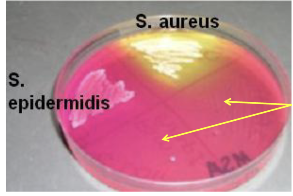 <p>what are the yellow lines?</p>