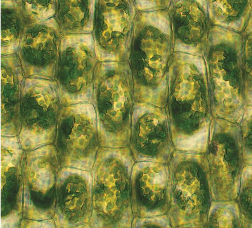 <p>What is plasmolysis usually accompanied by?</p>