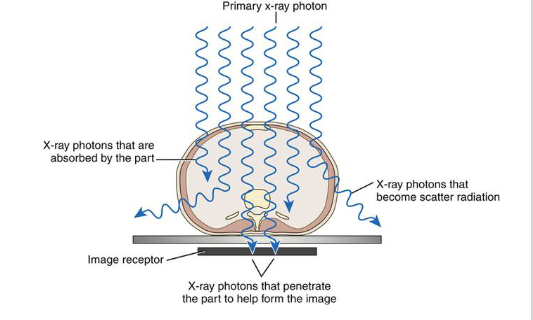 <p>primary : beam of photons before it interacts with patient </p><p>remnant : resulting beam that is able to exit from patient </p><p>scatter : radiation that interacts with matter and continues in a different direction </p><p>attenuation : primary radiation that is partially absorbed as it travels through the pt </p>