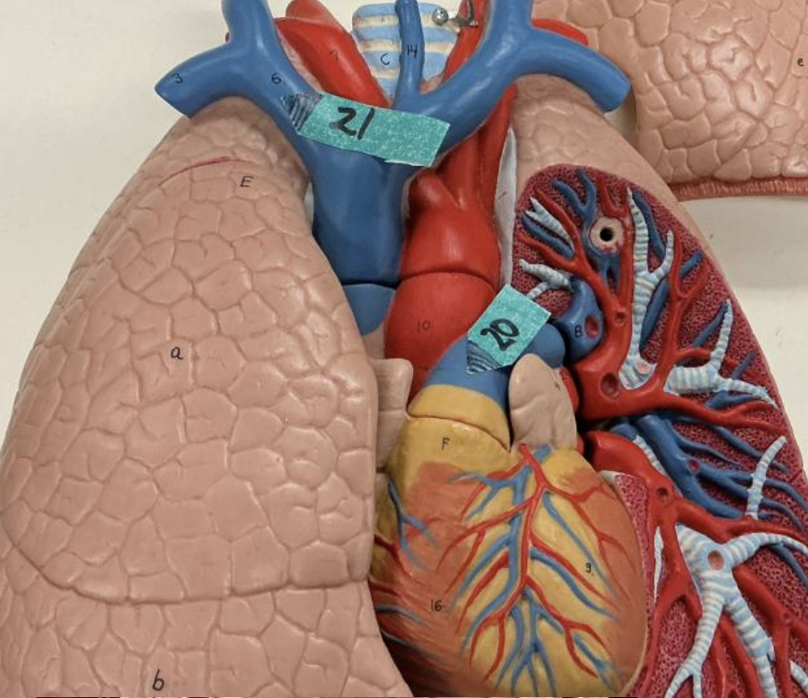 <p>______________ is the predominant connective tissue in the wall of the organ labeled 20.</p>