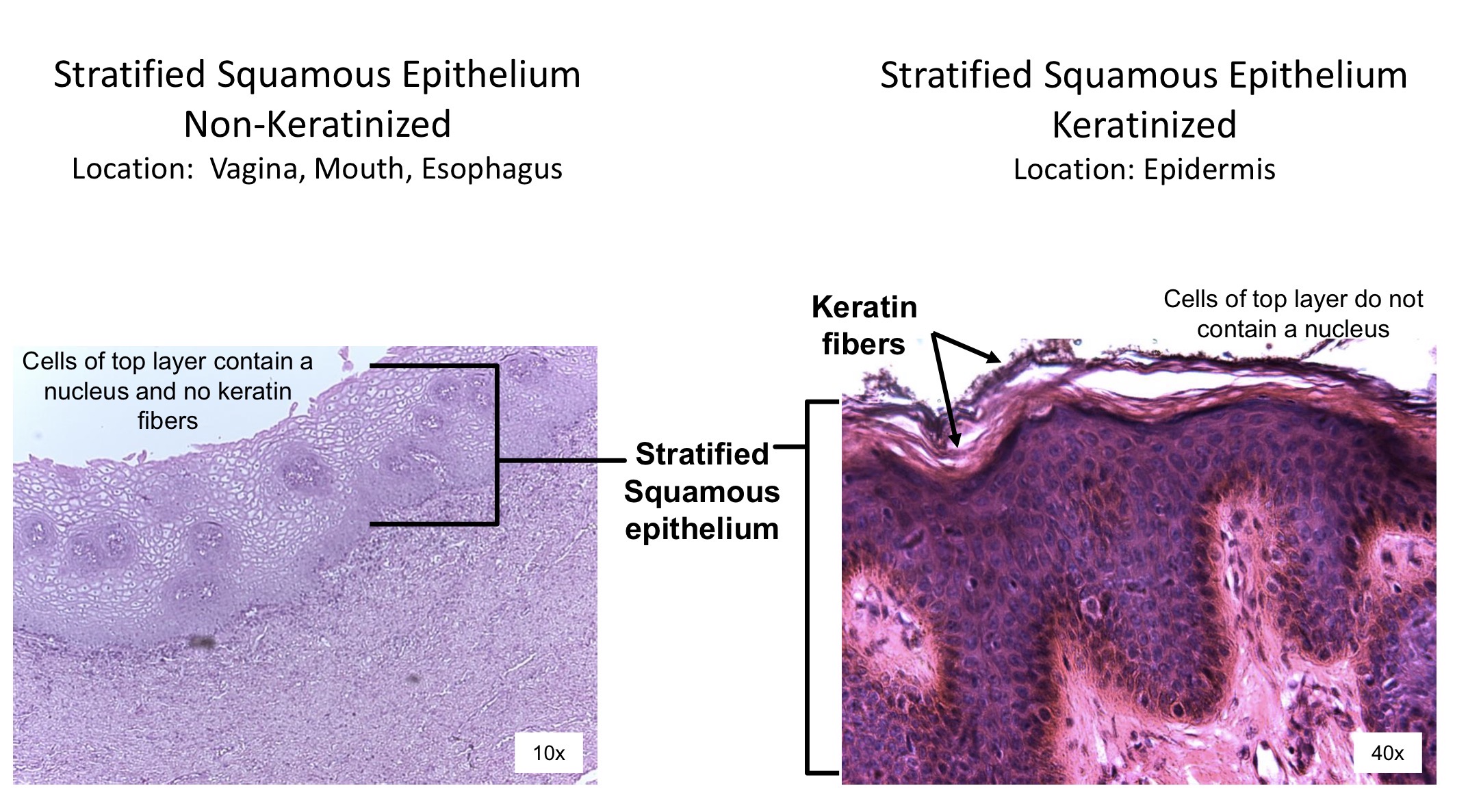 <ol><li><p>Stratified squamous epithelium </p></li><li><p>Keratin fibers </p></li></ol><p></p>