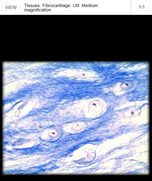 <p>Lateral meniscus</p>