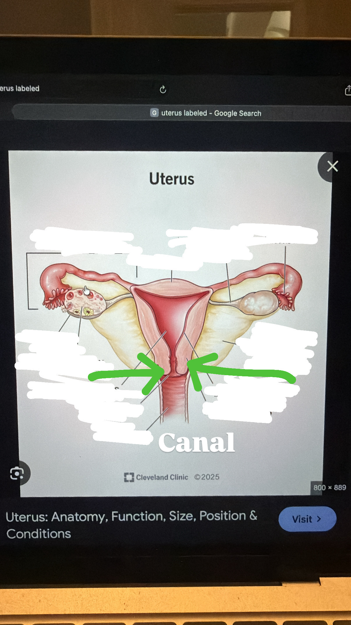 <p>a part of the cervix, where it narrows</p>