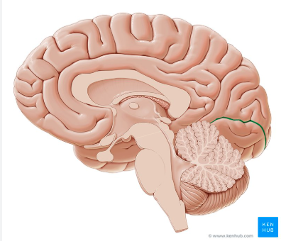 <p>Name this sulcus</p>