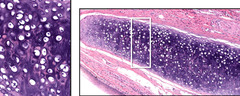 <p>Identify the tissue found in the epiglottis?</p>