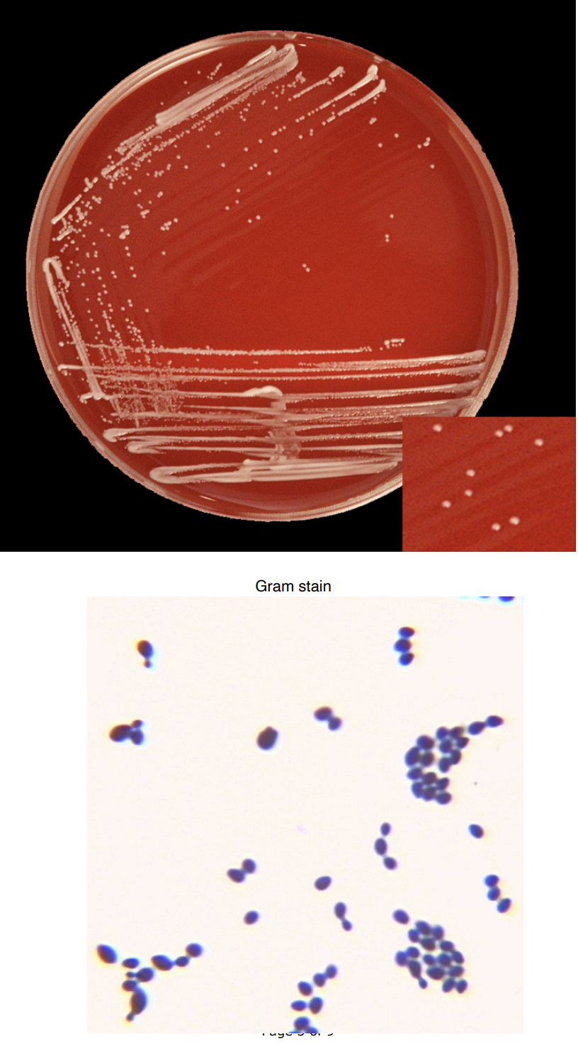 <p>Candida albicans</p>