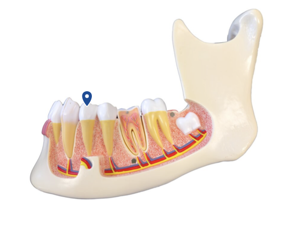 <p>Name this tooth type.</p>
