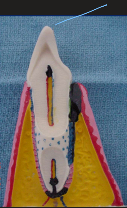 <p>This portion is calle the __</p>