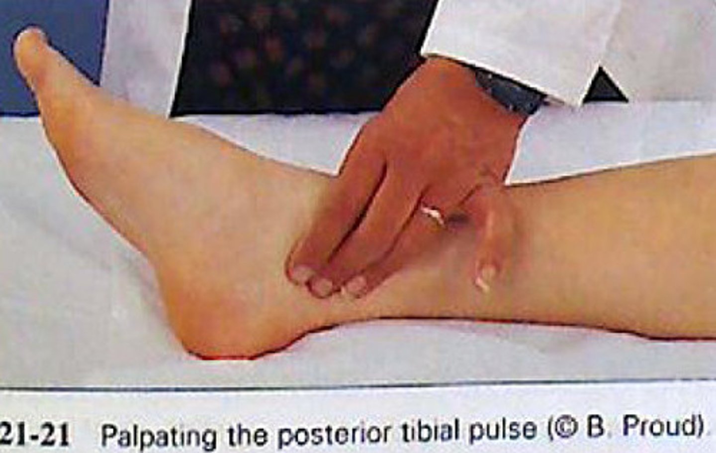 <p>on medial surface of ankle near ankle bone</p>