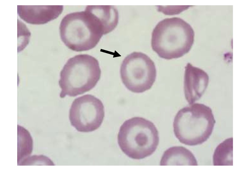 <p>Name this RBC</p>