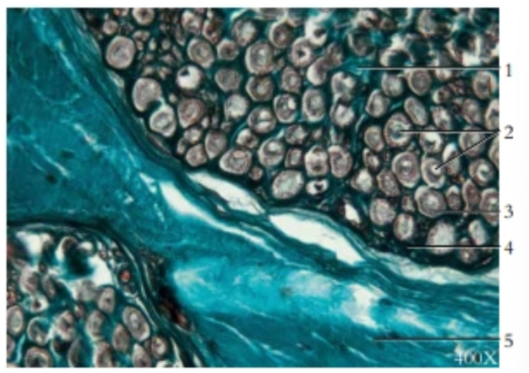 <p><span style="background-color: transparent;">Cross-section of a peripheral nerve</span></p>