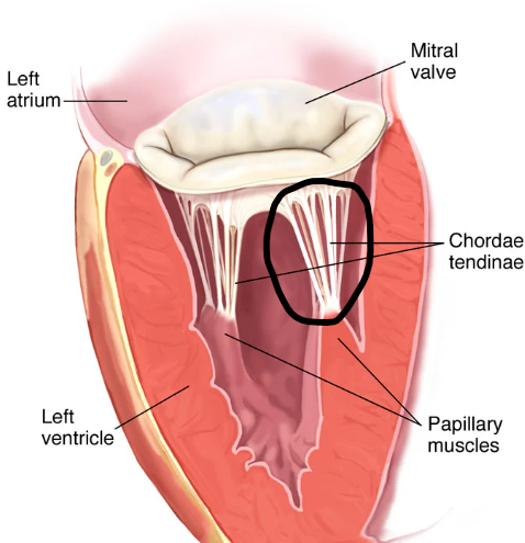 term image