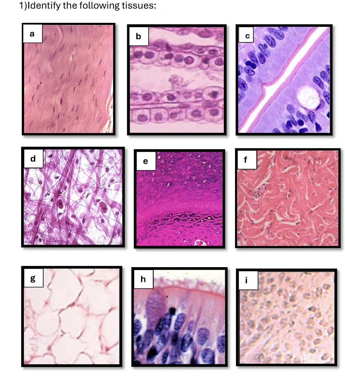 <p>What kind of tissue is e. ?</p>
