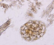 <p>Parasite or Artifact? Identify.</p>