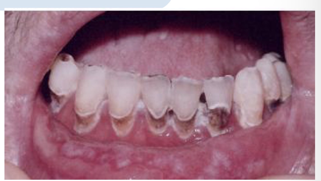 <p>CHẨN ĐOÁN ?</p>