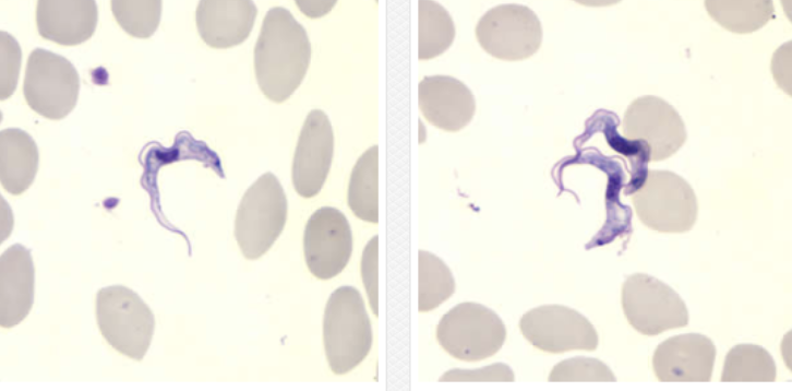 <p>causes west african sleeping sickness. specimens include blood lymph node aspirations & CSF (sediment). use giemsa-stained preparations for trypomastigotes (diagnostic stage). IgM testing on CSF or serum is diagnostic. from west & central africa, esp in shaded areas along stream banks where tsetse flies breed. humans only host.</p>