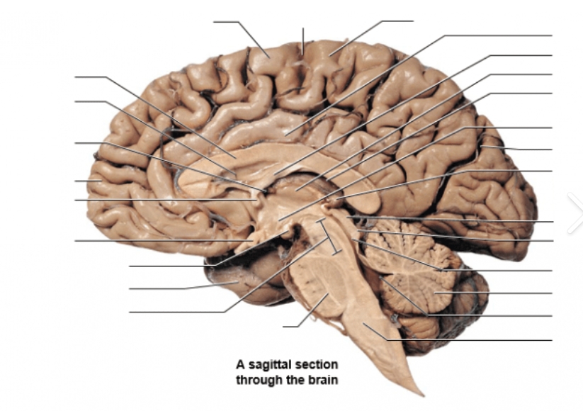 <p>Sagittal </p><p>*Mid-sagittal cut</p>