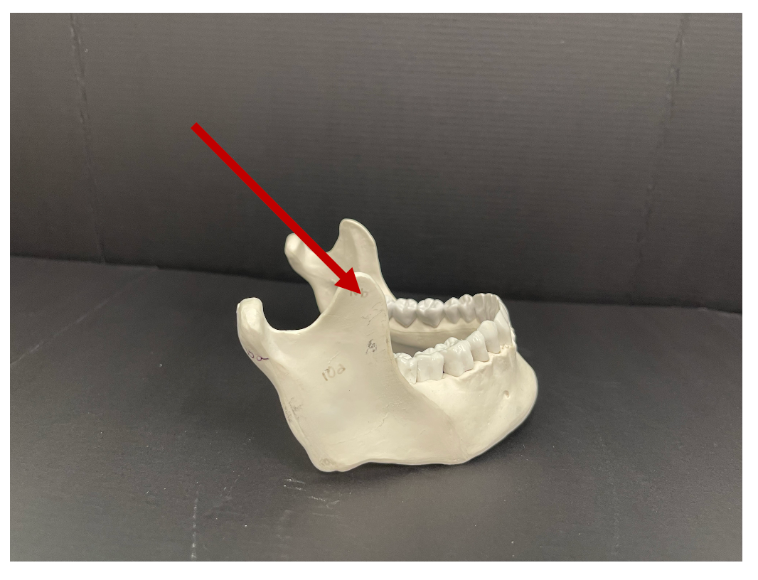 <p>Identify the bony landmark of the mandible that the arrow is pointing to.</p>
