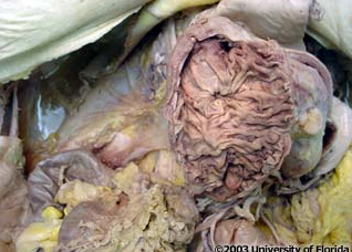 <p>what kind of folds are seen in all parts of the duodenum except the first part (as pictured)?</p>