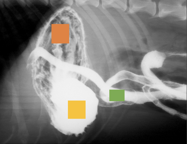 <p>Name the view and what portion of the organ is represented by the orange square:</p>