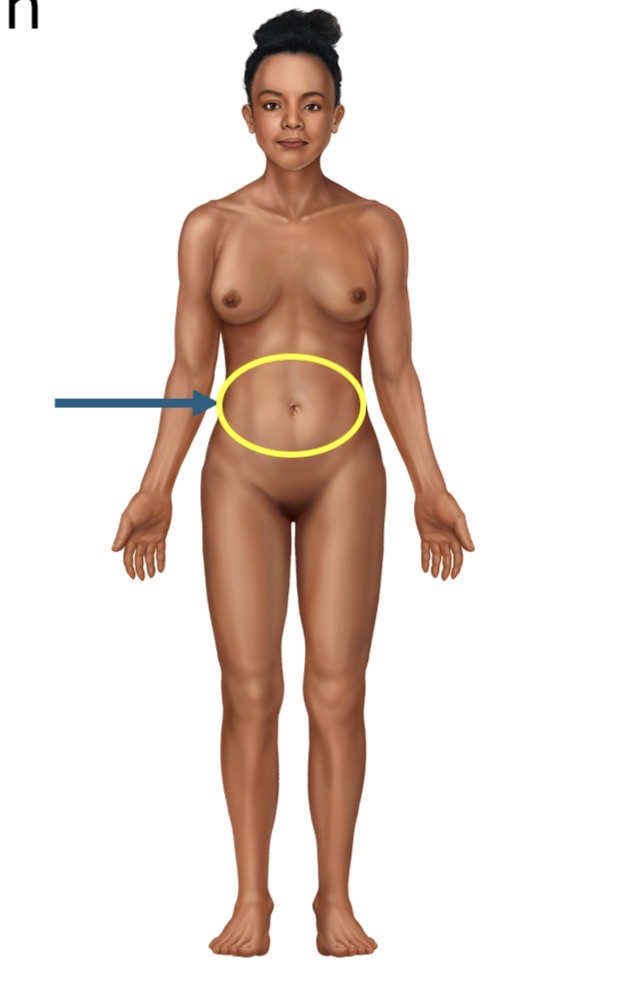 <p>Name the body part or region</p>
