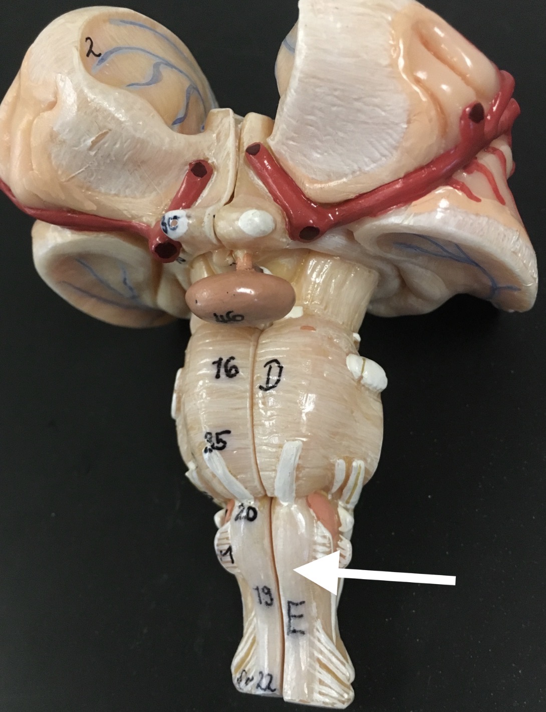 <p>What is white “baseball bat” the arrow is pointing to?</p>