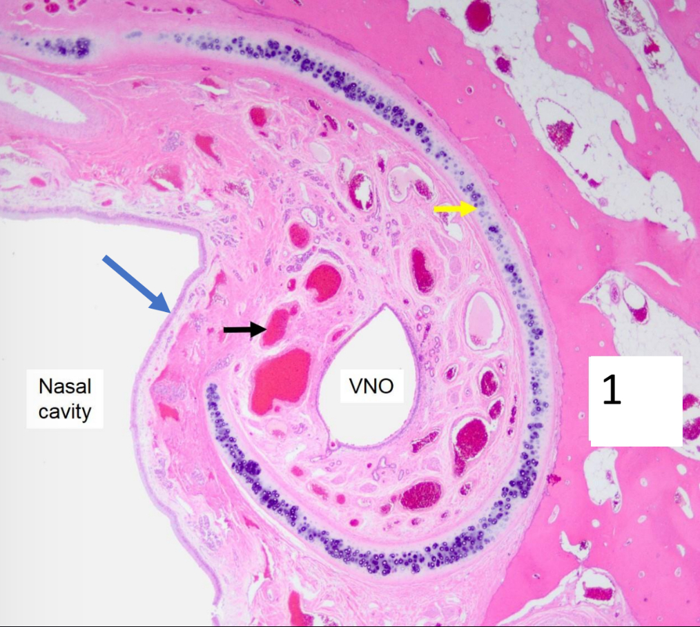 <p>Name the structure indicated by the black arrow.</p>