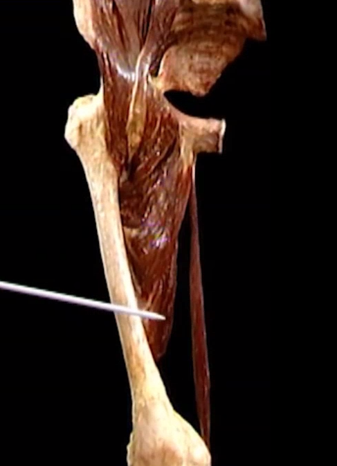 <p>Diep, anterior zicht</p>