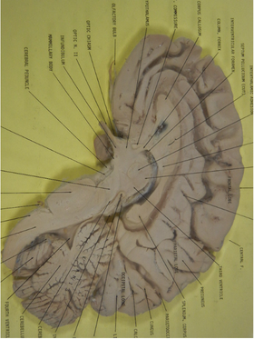 <p>What orientation?</p>