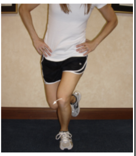 <p><strong>Purpose</strong></p><ul><li><p><span style="color: red;"><strong>Patellofemoral dysfunction during loaded knee flexion</strong></span></p></li></ul><p></p><p><strong>How to perform</strong></p><ol><li><p>pt standing on test leg</p></li><li><p>Ask pt to perform a slow, partial single-leg squat</p></li><li><p>Observe patellar tracking, trunk/pelvic control, femoral rotation, knee alignment, and balance</p></li><li><p>Palpate around the patellofemoral joint may be used to identify pain or crepitus and the knee flexion angle at which sx occurs</p></li></ol><p></p><p><strong>Positive test</strong></p><ul><li><p><span style="color: red;"><strong>Patellofemoral pain</strong></span><strong> </strong>or <span style="color: red;"><strong>crepitus</strong></span> during the squat</p></li></ul><p></p><p><strong>Clinical pearl:</strong> Abnormal tracking or loss of lower-quarter control should be documented, but it is not tissue-specific by itself</p>