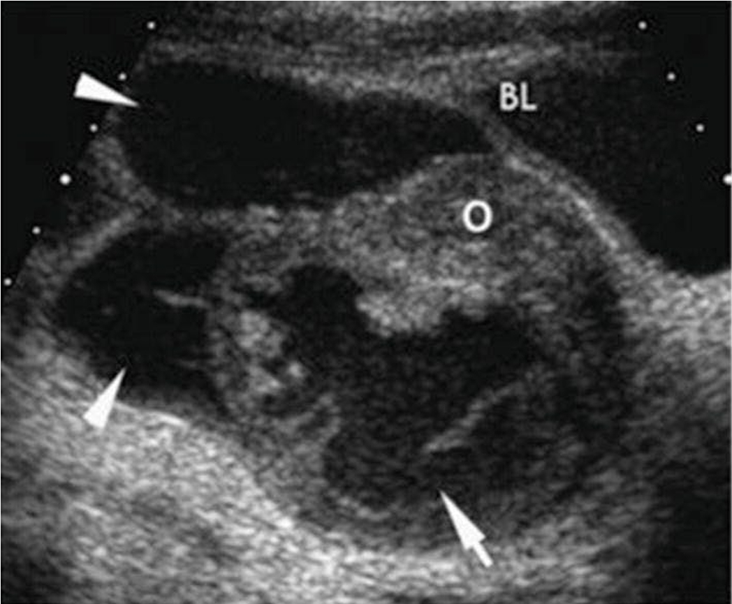 term image