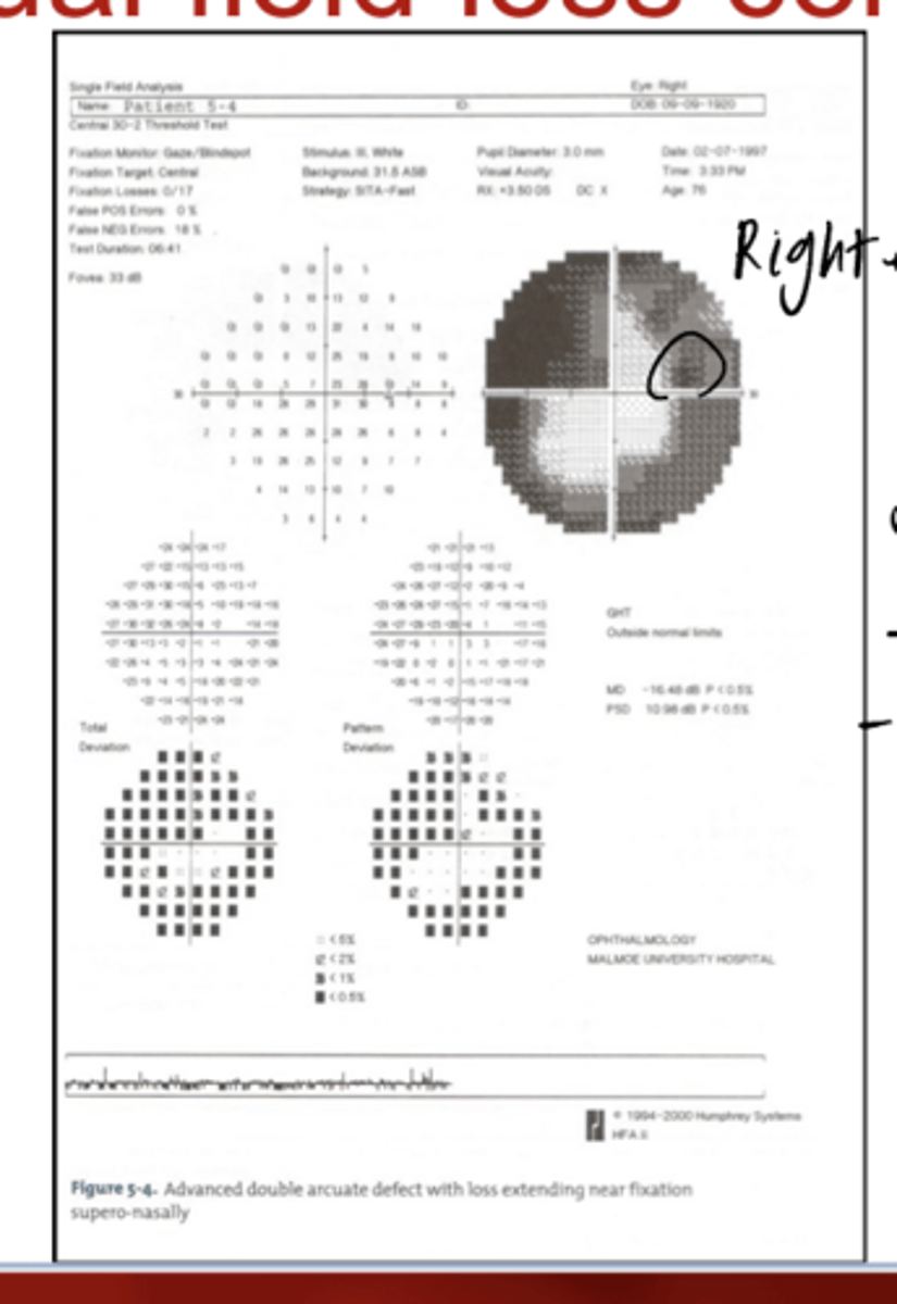 <p>A defect on superior VF will represent the ______ nerve</p>