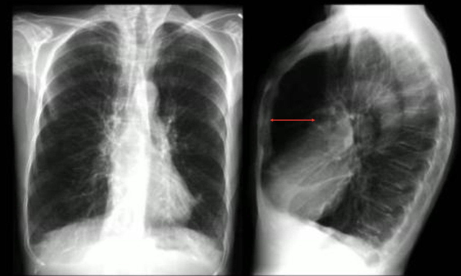 <p>Diagnóstico? Destaque as principais características da radiografia desse quadro</p>